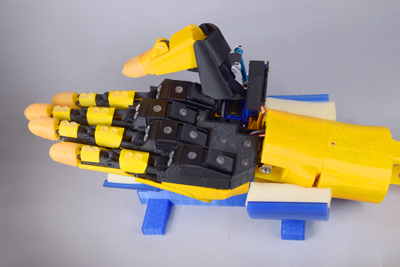 prosthetic hand with AI